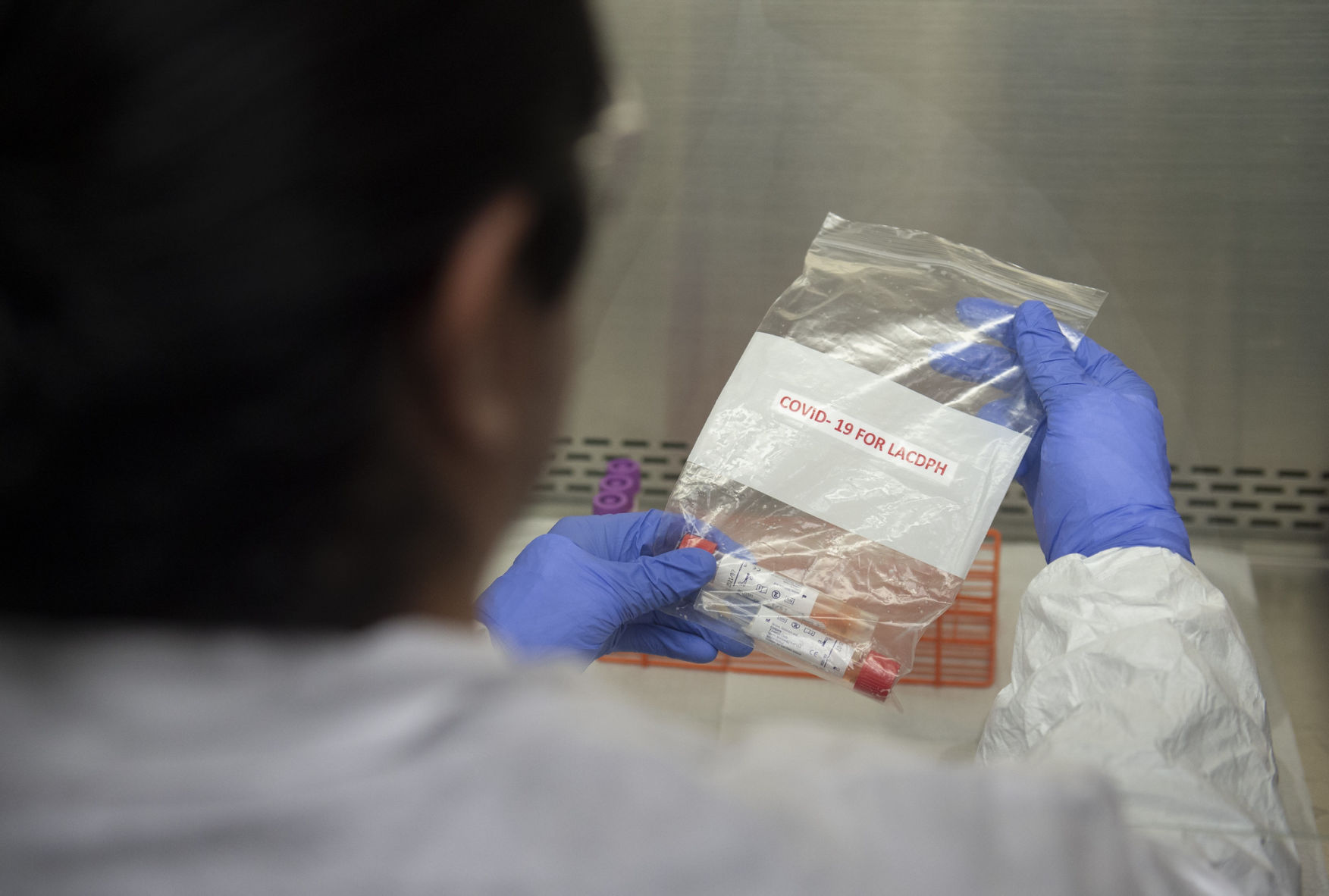 Los Angeles County Department of Public Health conducts Polymerase Chain Reaction